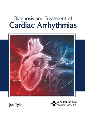 Diagnosis and Treatment of Cardiac Arrhythmias - 