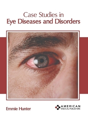 Case Studies in Eye Diseases and Disorders - 