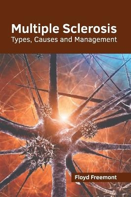 Multiple Sclerosis: Types, Causes and Management - 