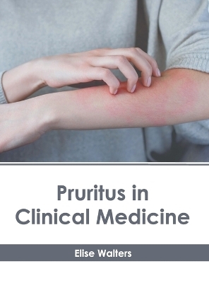 Pruritus in Clinical Medicine - 