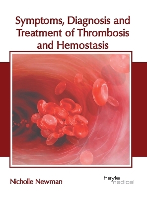 Symptoms, Diagnosis and Treatment of Thrombosis and Hemostasis - 