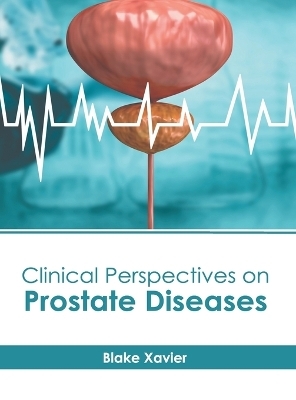 Clinical Perspectives on Prostate Diseases - 