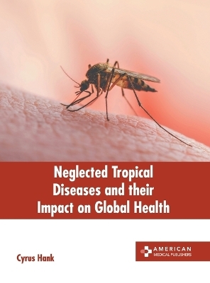 Neglected Tropical Diseases and Their Impact on Global Health - 