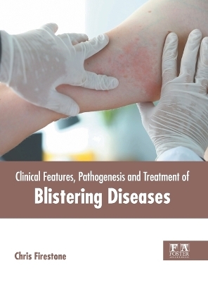 Clinical Features, Pathogenesis and Treatment of Blistering Diseases - 