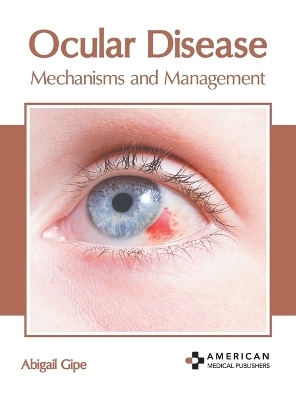 Ocular Disease: Mechanisms and Management - 