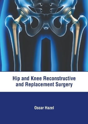 Hip and Knee Reconstructive and Replacement Surgery - 