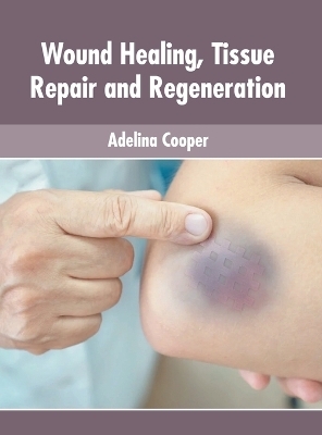 Wound Healing, Tissue Repair and Regeneration - 