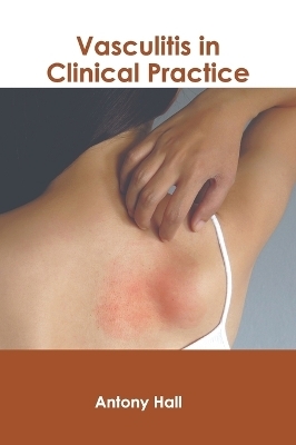 Vasculitis in Clinical Practice - 