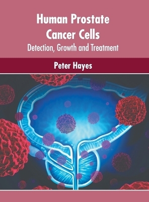 Human Prostate Cancer Cells: Detection, Growth and Treatment - 