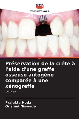 Préservation de la crête à l'aide d'une greffe osseuse autogène comparée à une xénogreffe - Prajakta Heda, Grishmi Niswade