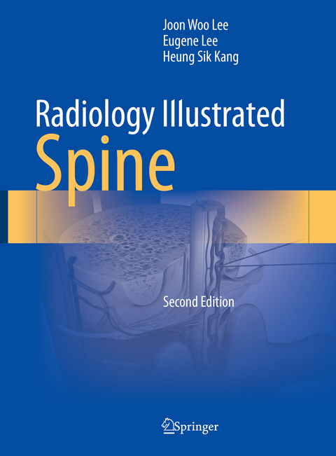 Radiology Illustrated: Spine - Joon Woo Lee, Eugene Lee, Heung Sik Kang