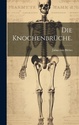 Die Knochenbrüche. - Julius Von Mebes