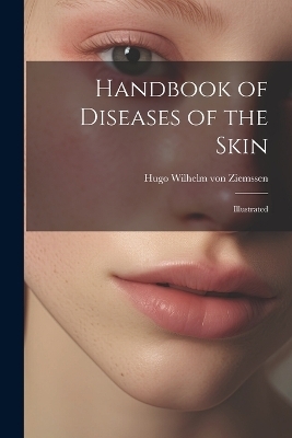 Handbook of Diseases of the Skin; Illustrated - Hugo Wilhelm Von Ziemssen