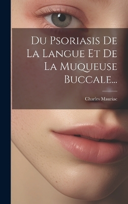 Du Psoriasis De La Langue Et De La Muqueuse Buccale... - Charles Mauriac