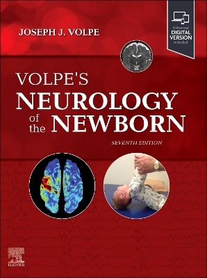 Volpe's Neurology of the Newborn - 