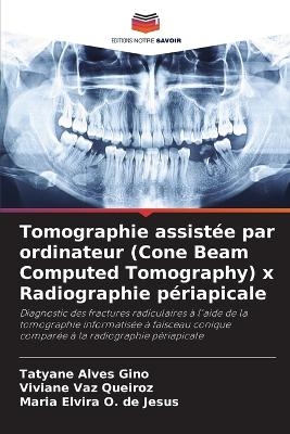 Tomographie assistée par ordinateur (Cone Beam Computed Tomography) x Radiographie périapicale - Tatyane Alves Gino, Viviane Vaz Queiroz, Maria Elvira O de Jesus