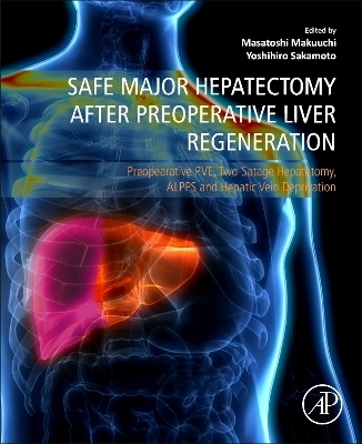 Safe Major Hepatectomy after Preoperative Liver Regeneration - 