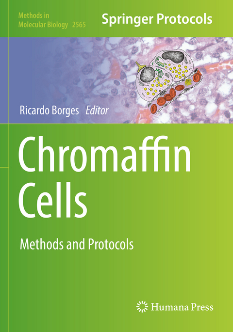 Chromaffin Cells - 