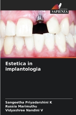 Estetica in implantologia - Sangeetha Priyadarshini K, Russia Marimuthu, Vidyashree Nandini V