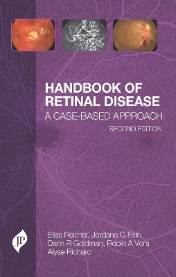 Handbook of Retinal Disease - Elias Reichel, Jordana G Fein, Darin R Goldman, Robin A Vora, Alyse Richard