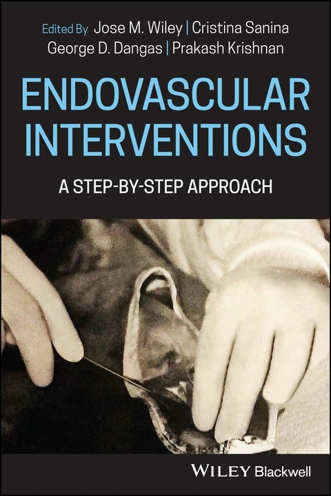 Endovascular Interventions - Jose Wiley, Cristina Sanina, George D. Dangas, Prakash Krishnan