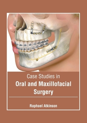 Case Studies in Oral and Maxillofacial Surgery - 