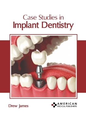 Case Studies in Implant Dentistry - 