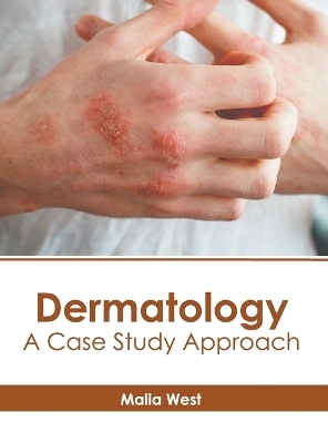 Dermatology: A Case Study Approach - 