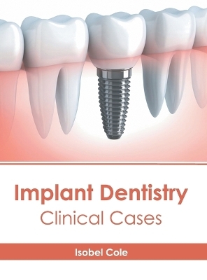 Implant Dentistry: Clinical Cases - 