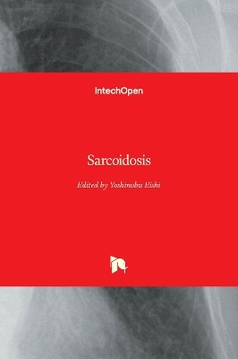Sarcoidosis - 