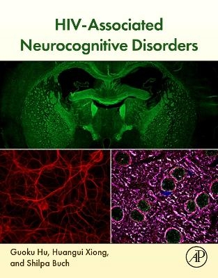 HIV-Associated Neurocognitive Disorders - 