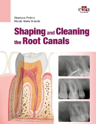 Shaping and Cleaning the Root Canal System - Gianluca Plotino, Nicola Maria Grande