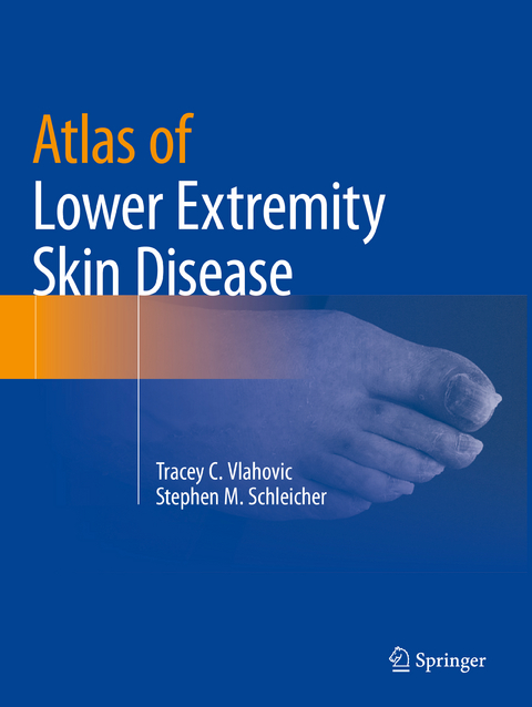 Atlas of Lower Extremity Skin Disease - Tracey C. Vlahovic, Stephen M. Schleicher