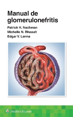 Manual de glomerulonefritis - Patrick Henry Nachman, Edgar V. Lerma, Michelle Rheault