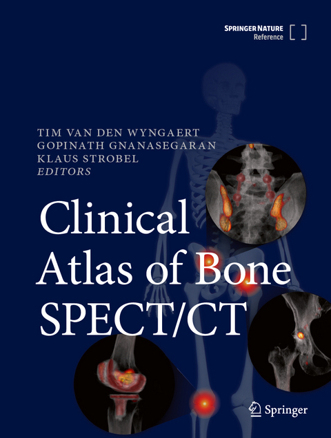 Clinical Atlas of Bone SPECT/CT - 