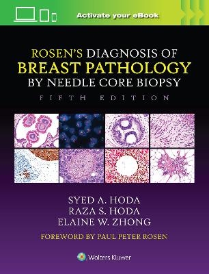 Rosen's Diagnosis of Breast Pathology by Needle Core Biopsy - Syed A. Hoda, Raza S. Hoda, Elaine Zhong