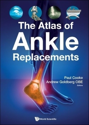 Atlas Of Ankle Replacements, The - 