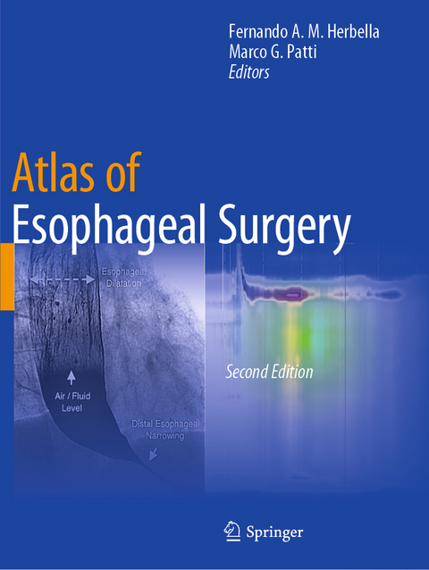 Atlas of Esophageal Surgery - 
