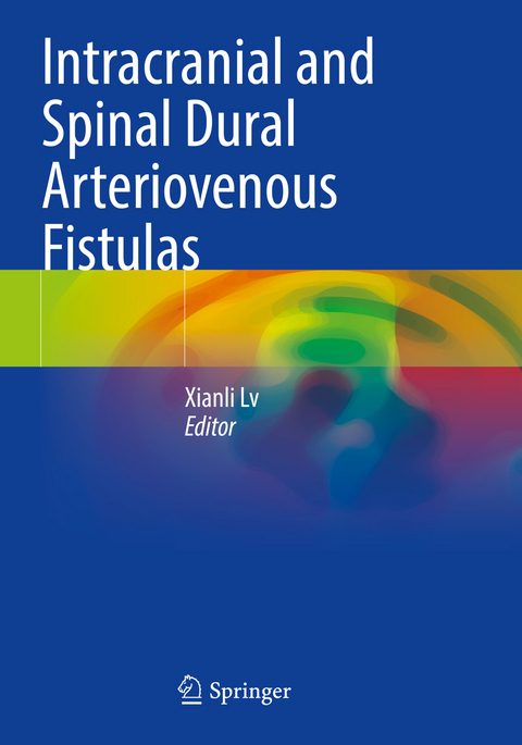 Intracranial and Spinal Dural Arteriovenous Fistulas - 