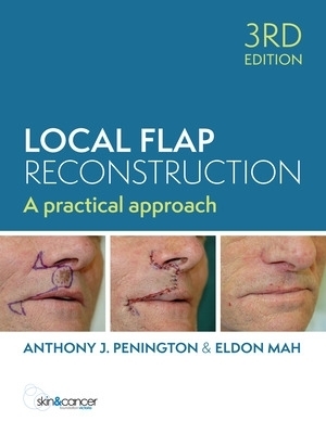 Local Flap Reconstruction - Anthony Penington, Eldon Mah