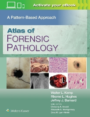 Atlas of Forensic Pathology: A Pattern Based Approach: Print + eBook with Multimedia - Walter L. Kemp