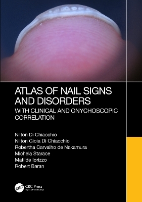 Atlas of Nail Signs and Disorders with Clinical and Onychoscopic Correlation - Nilton Di Chiacchio, Nilton Gioia Di Chiacchio, Robertha Carvalho de Nakamura, Michela Starace, Matilde Iorizzo