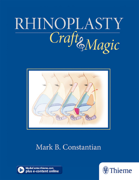 Rhinoplasty - Mark B. Constantian