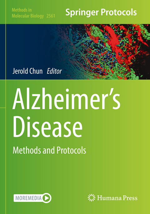 Alzheimer’s Disease - 