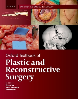 Oxford Textbook of Plastic and Reconstructive Surgery - 