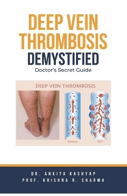 Deep Vein Thrombosis Demystified - Dr Ankita Kashyap, Prof Krishna N Sharma