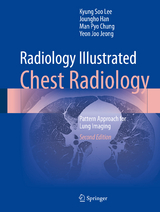 Radiology Illustrated: Chest Radiology - Lee, Kyung Soo; Han, Joungho; Chung, Man Pyo; Jeong, Yeon Joo