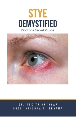 Stye Demystified - Dr Ankita Kashyap, Prof Krishna N Sharma