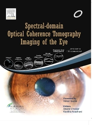 Spectral-domain Optical Coherence Tomography Imaging of the Eye - Anand Vinekar