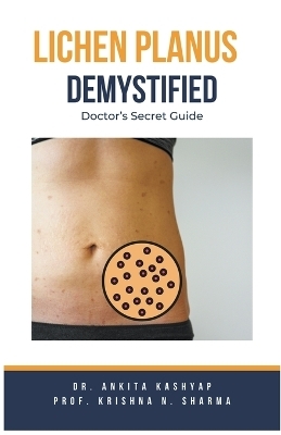 Lichen Planus Demystified Doctors Secret Guide - Dr Ankita Kashyap, Prof Krishna N Sharma